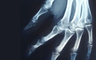 LE PHOSPHORE - Où est-il ? A quoi sert-il ? Ses maladies